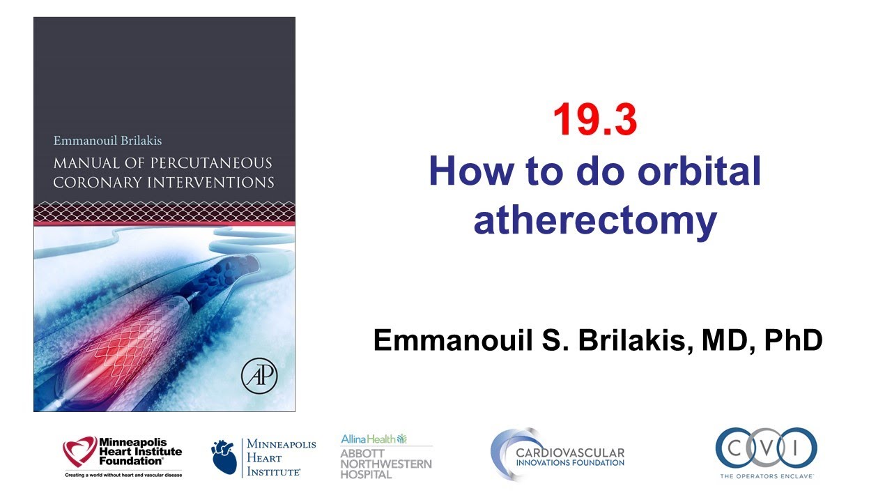 19.3 Orbital atherectomy: Manual of PCI