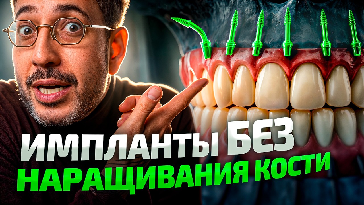 Костная пластика УЖЕ в прошлом?! Базальная имплантация зубов 2026