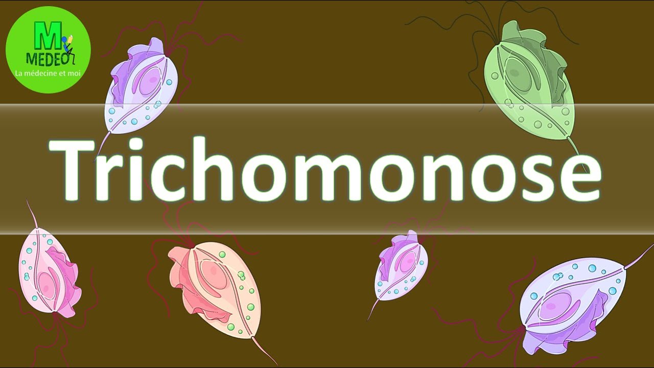 TRICHOMONOSE : cours de parasitologie m&eacute;dicale