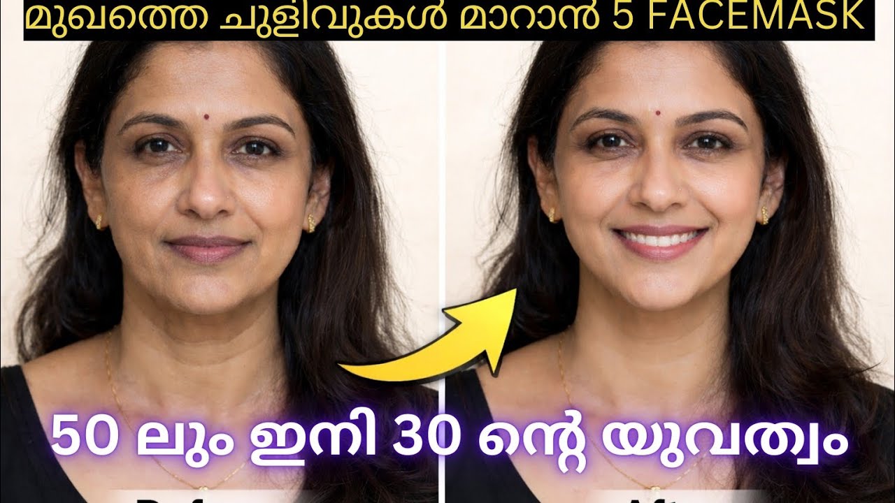 30 കഴിഞ്ഞാൽ നിർബന്ധമായും ചെയ്യൂ! മുഖത്തെ വർദ്ധ്യക്യം തൊടില്ല...Instant Tightening.. 
