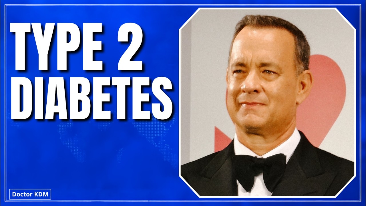 Tom Hanks Developed Type 2 Diabetes - Don&rsquo;t Ignore These Warning Signs