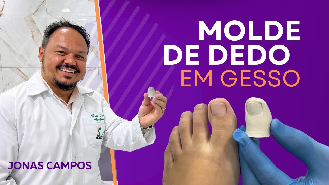 Como fazer molde de dedo em gesso