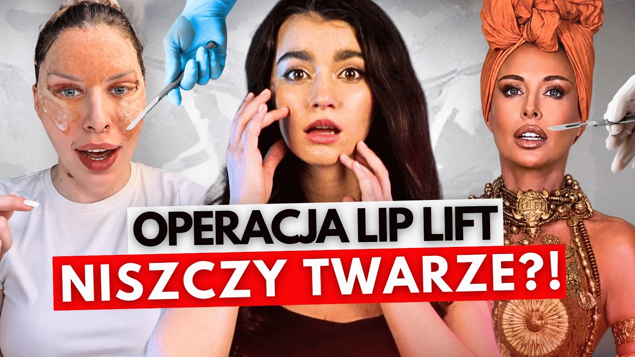 MODA NA KR&Oacute;LICZE USTA! LIP LIFT NISZCZY TWARZ?