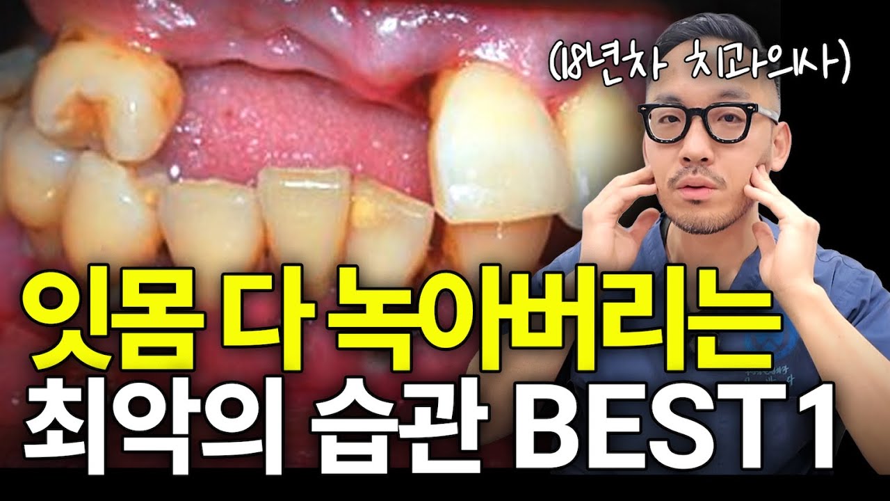 ‘이 습관’ 있으면 잇몸 다 녹습니다