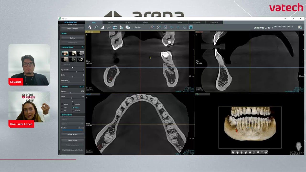 Ez3D-i na prática: implantes 100% seguros em 3D