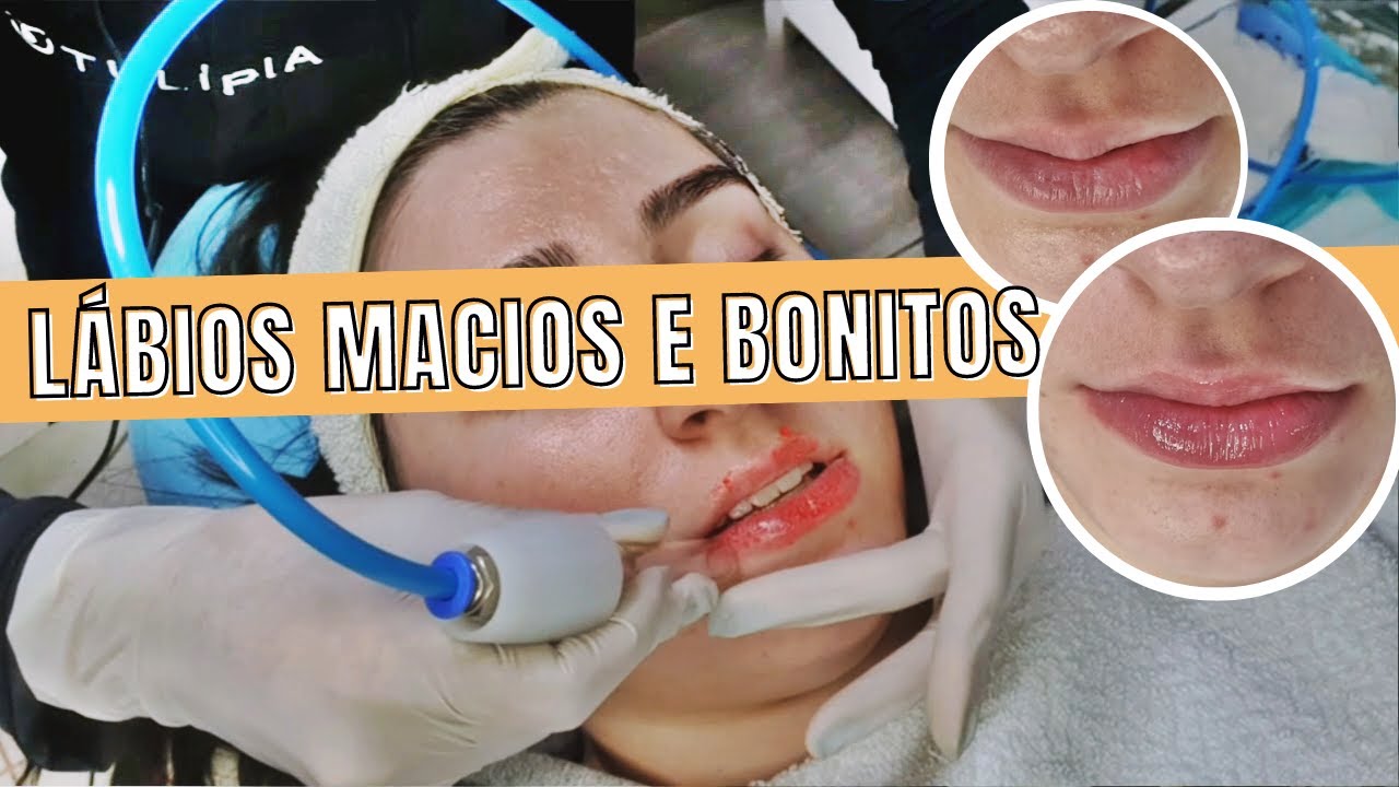 PROTOCOLO LABIAL COM TULÍPIA |Revitalização Sweet Lips + DICAS DE VENDA