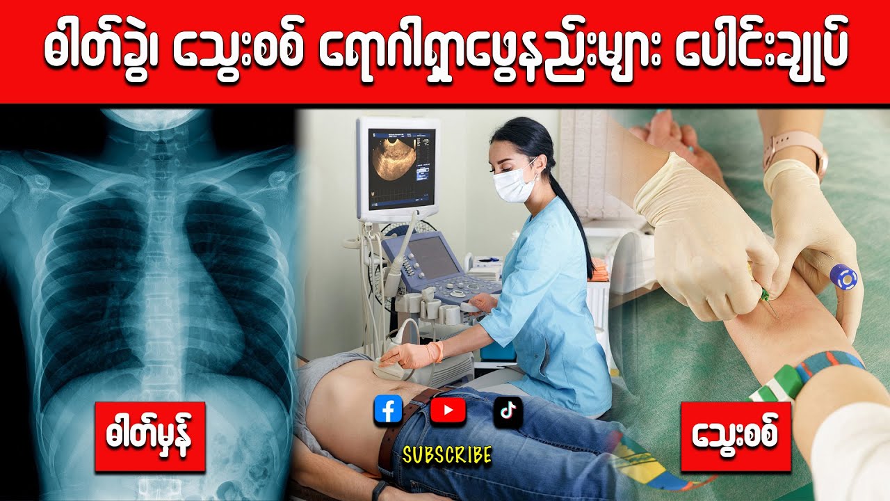 သွေးစစ်တာ​တွေ တီဗီဓါတ်မှန်ရိုက်တာ​တွေ လုပ်ကိုလုပ်ရတာ ဒီအချ​က်​တွေကြောင့်ပါ