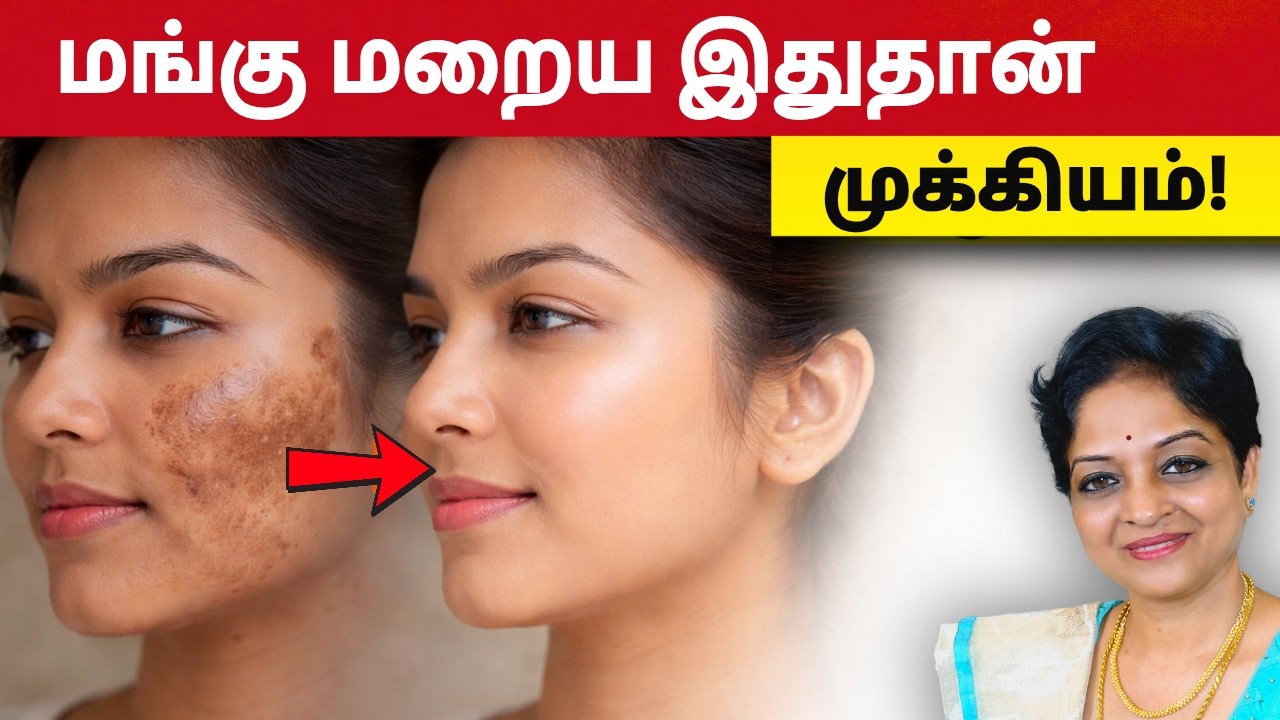 கரும்புள்ளி மறைய ஃபேஸ் பேக் மட்டும் போதாது… இதுவும் முக்கியம் | Tamil Health Tips