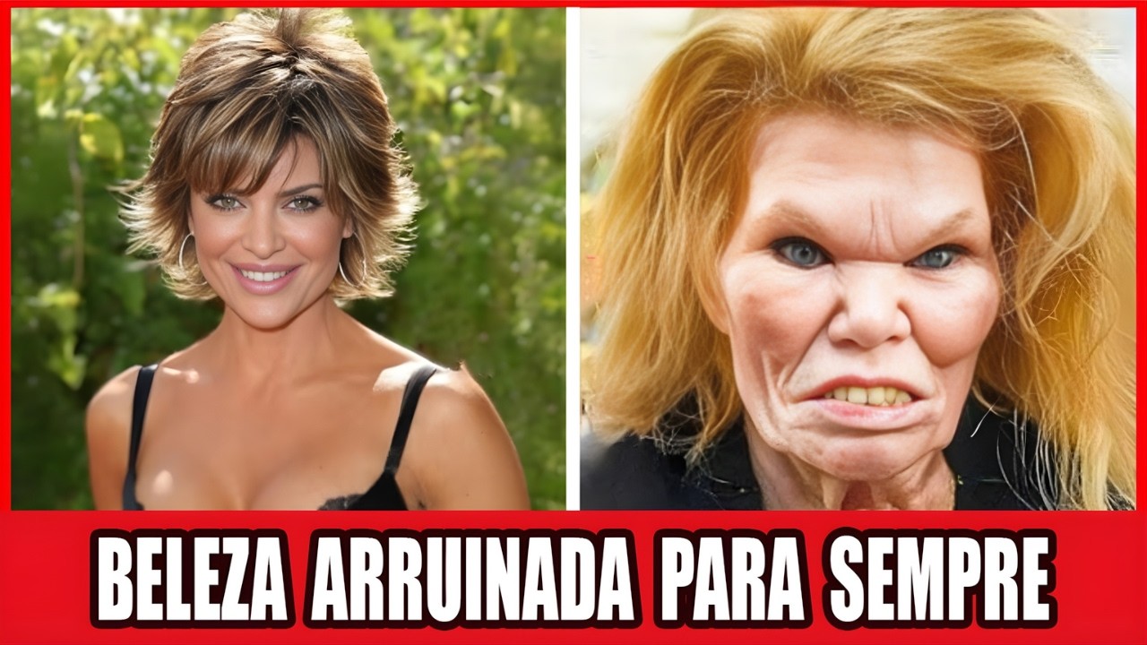 10 Famosos De Hollywood Que Mudaram Demais O Visual Com Cirurgia Plástica | Antes E Depois 2026