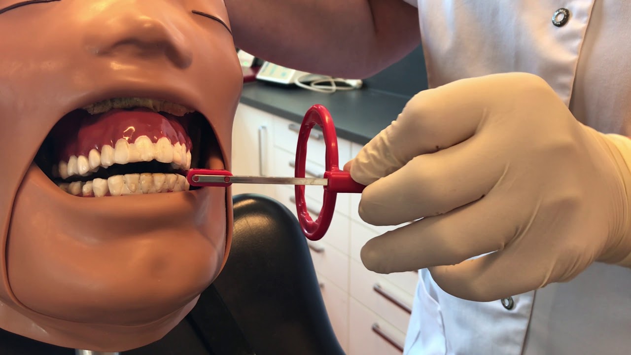 Korte instructievideo: R&ouml;ntgenopname maken met instelapparatuur