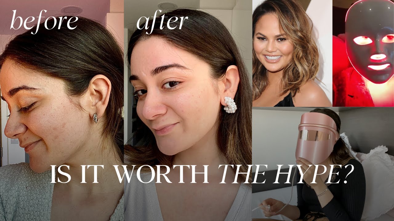 Trying The Celebrity LED Face Mask For Acne | SHOCKING RESULTS - LED Light Therapy