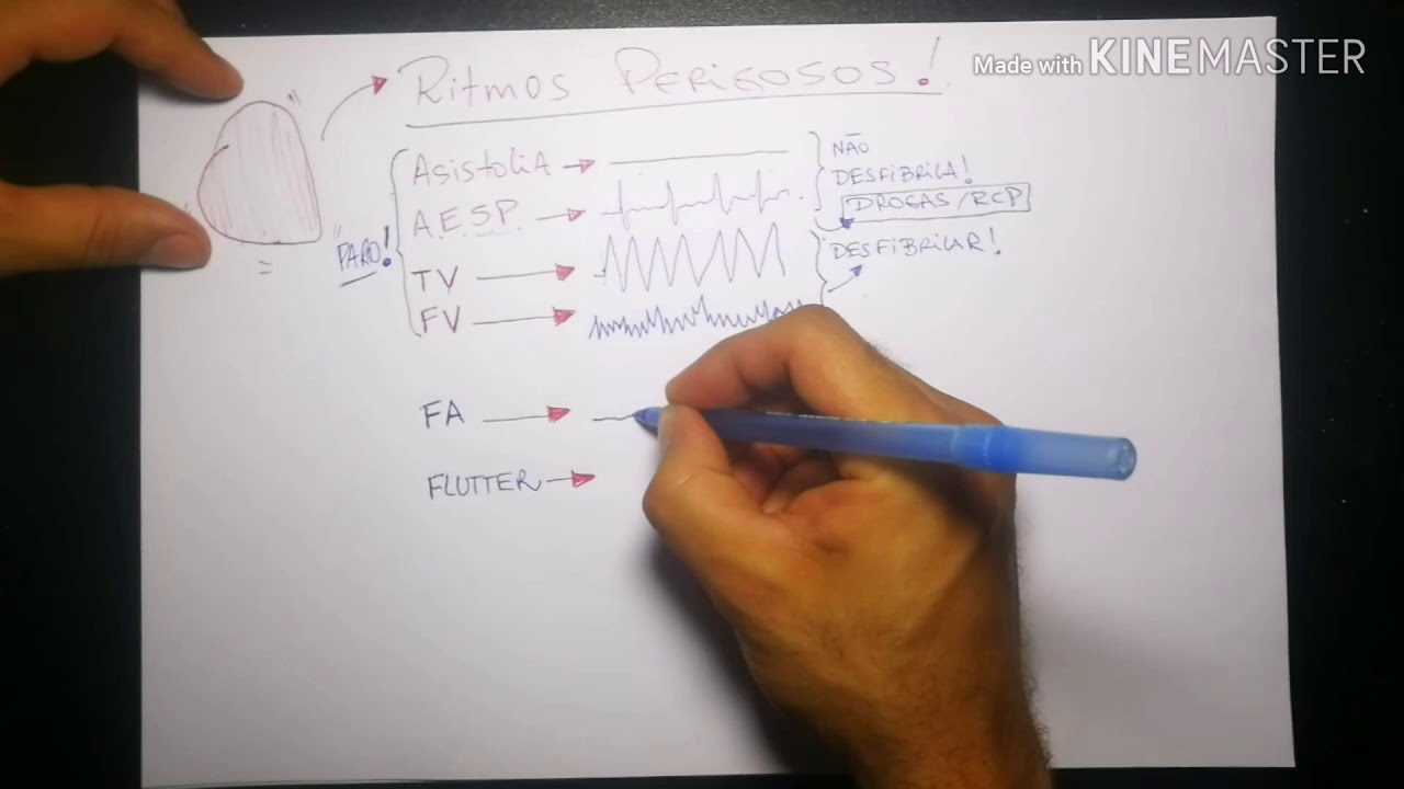 ECG - RITMOS PERIGOSOS