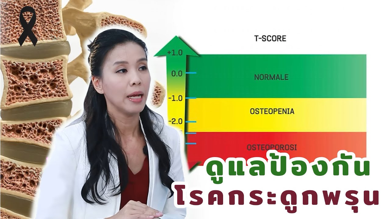 ดูแลป้องกันโรคกระดูกพรุน EP224/2 | แพทย์หญิงศรีศิริ ศิริวนารังสรรค์