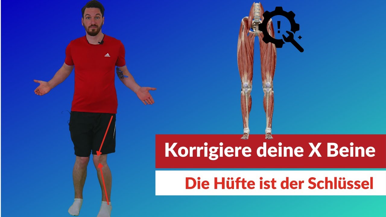 X Beine aus Hüftfehlstellung loswerden - so geht's! Training + Ursachentest