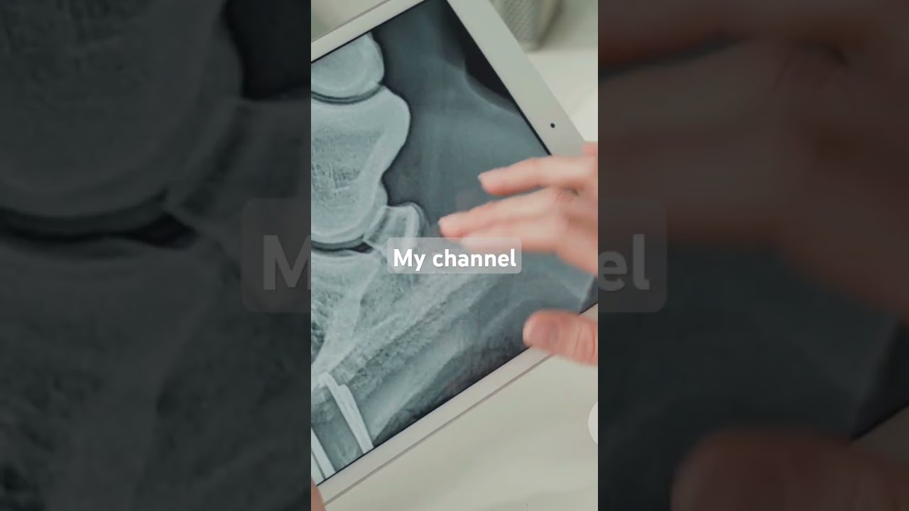 Why Navicular Disease Is Not A Death Sentence