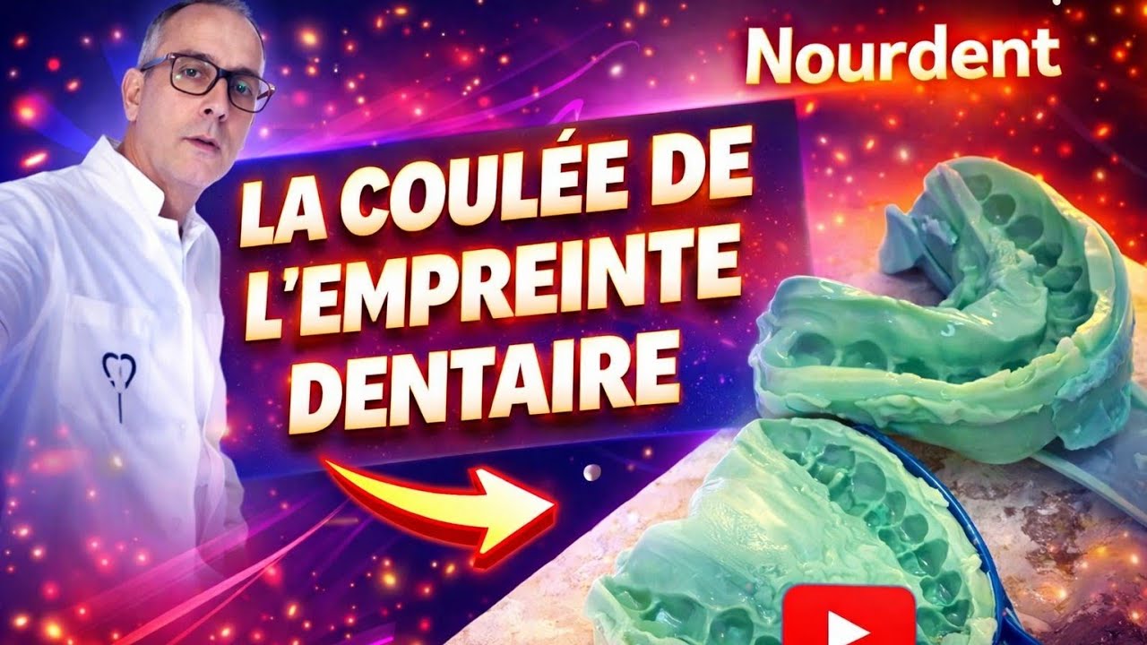 La coulée de l'empreinte dentaire