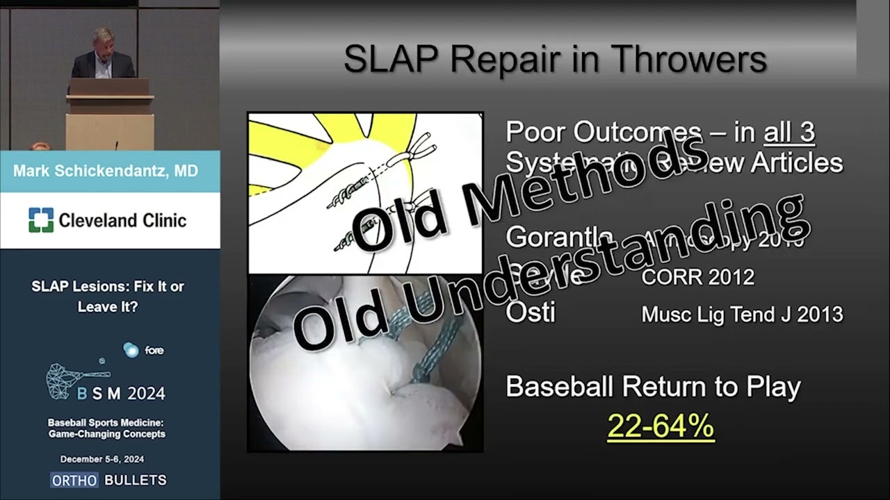 SLAP Lesions: Fix It or Leave It - Mark Schickendantz, MD