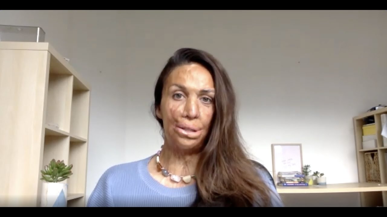 Turia Pitt and Margie Warrell: Mindset is everything during tough times