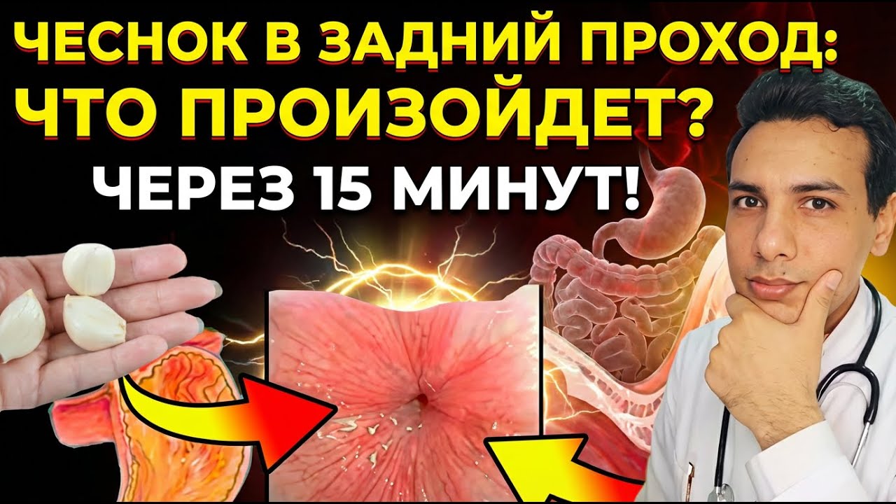 Введение чеснока в анус для лечения паразитов, простаты, Helicobacter pylori, геморроя и др