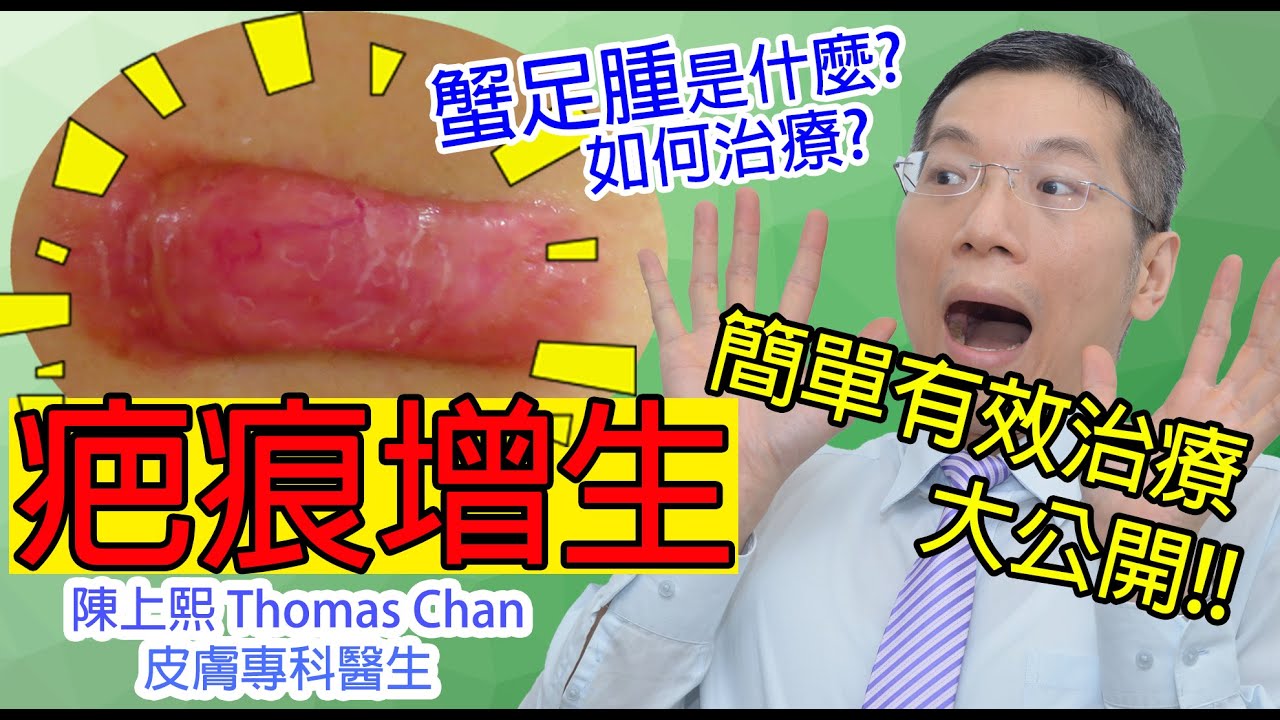 增生疤痕 | 增生疤痕治療過程有片睇! |  皮膚專科醫生 | 增生疤痕有治療方法? | 蟹足腫又是什麼呢?
