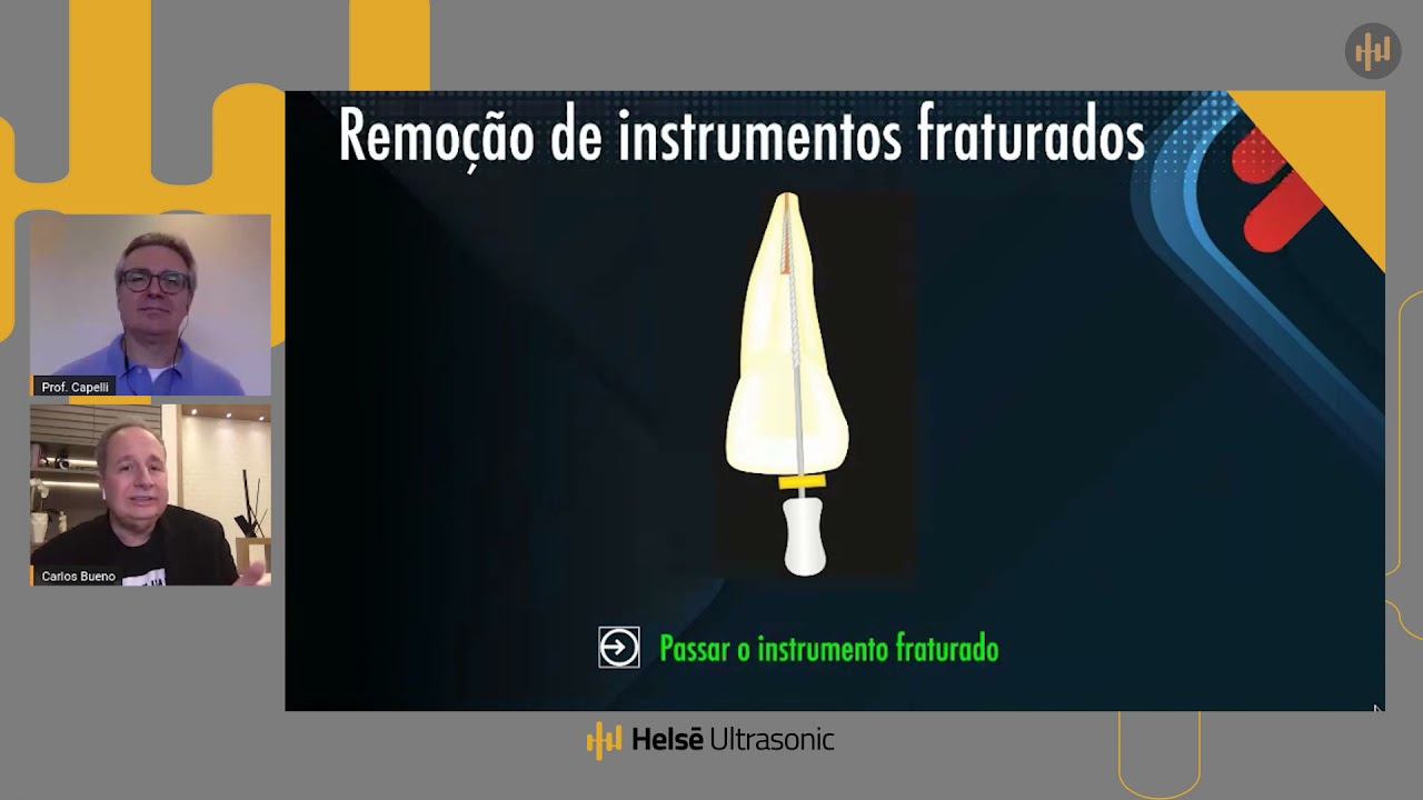 HELSE TALKS - COMO REMOVER INSTRUMENTO FRATURADO