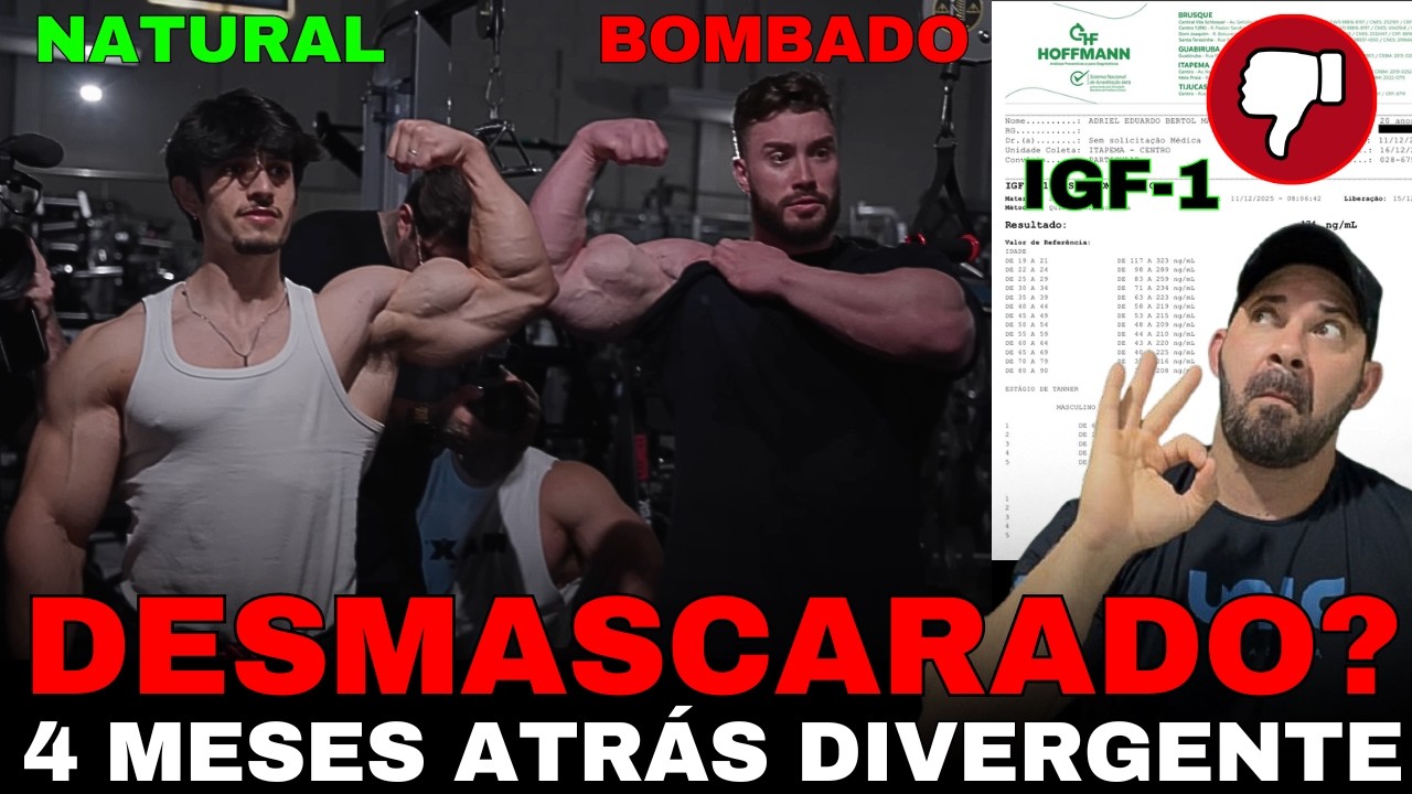 (A VERDADE) VAZA EXAMES  DO DUDU FITA 4 MESES ATR&Aacute;S