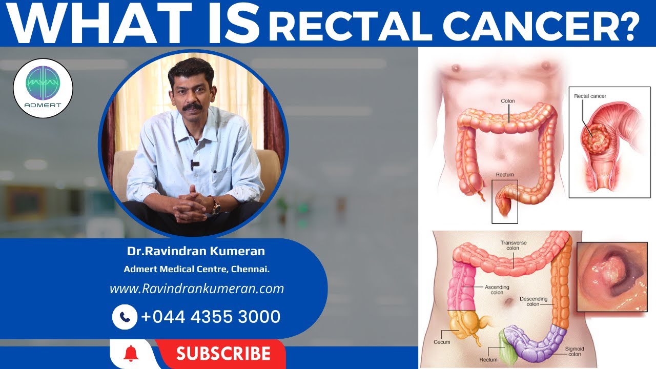 Rectal Cancer Explained in Tamil | Dr.Ravindran Kumeran | Tamil Medical Tips