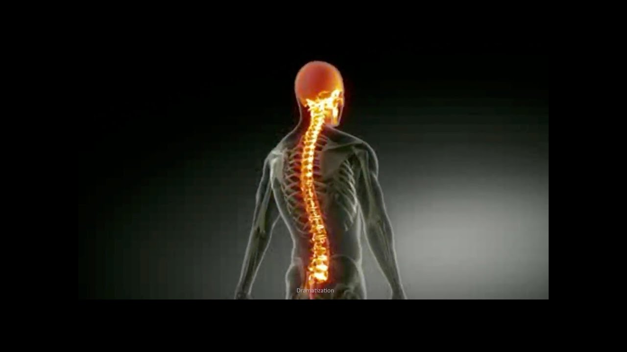 Quadriplegic Info - What is Quadriplegia?