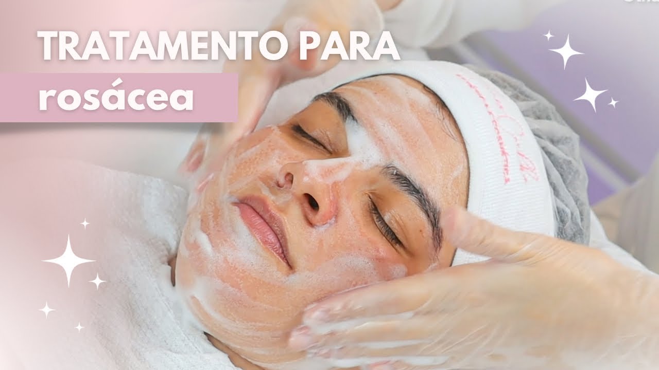 PROTOCOLO FACIAL EM PELE COM ROSÁCEA