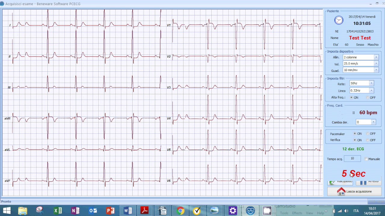 Pc Ecg Cardioshield: connessione tramite USB