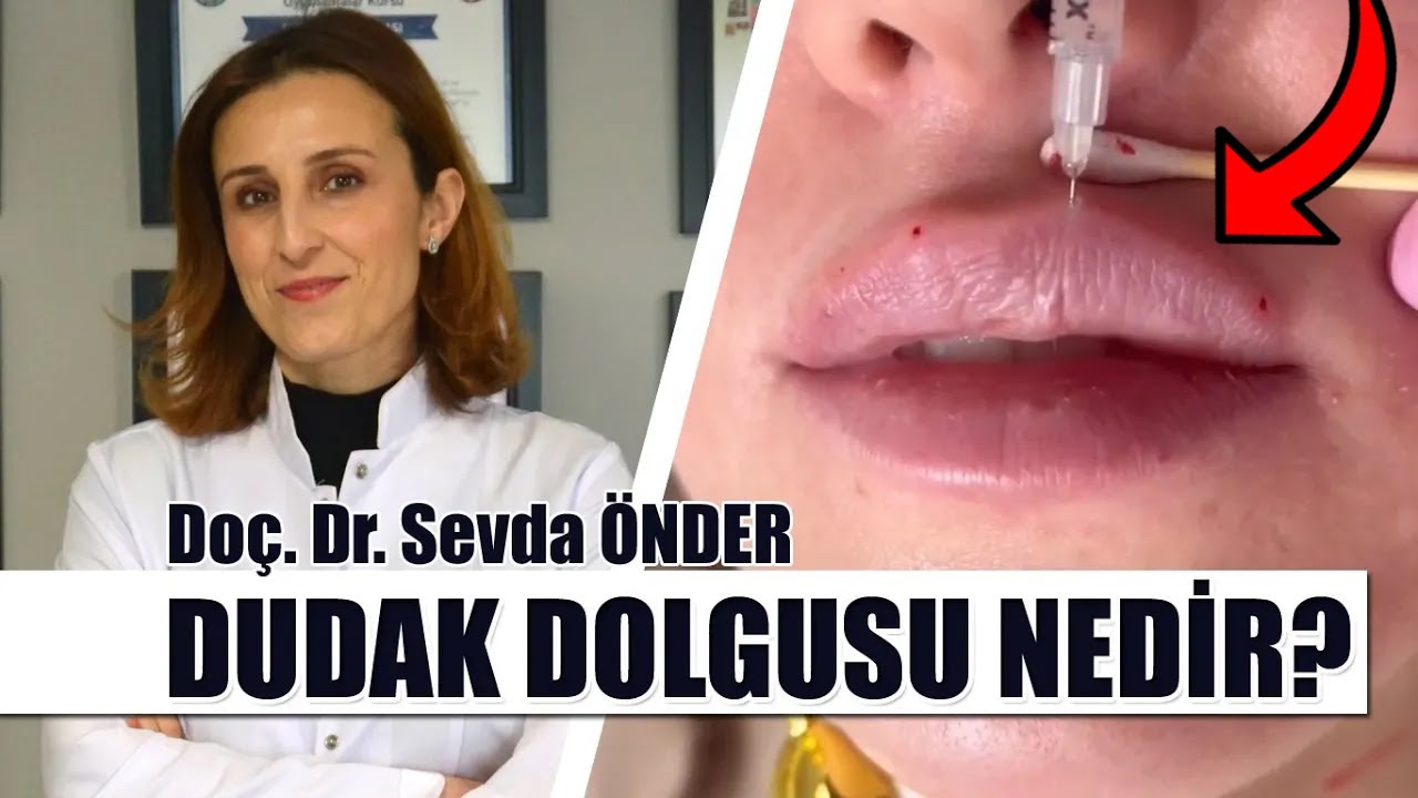 Dudak Dolgusu ile Doğal ve Dolgun Dudaklar Mümkün mü? Dudak Dolgusu Ne Kadar Süre Etkili?