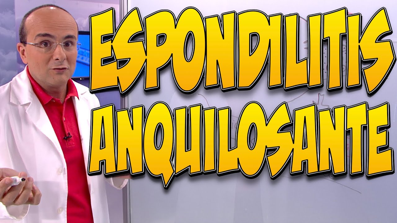 ESPONDILITIS ANQUILOSANTE, CAUSAS, HERENCIA, SÍNTOMAS, DIAGNÓSTICO, TRATAMIENTO y PREVENCIÓN