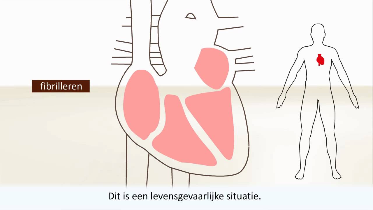 Hartritmestoornissen - Wat is een hartritmestoornis?