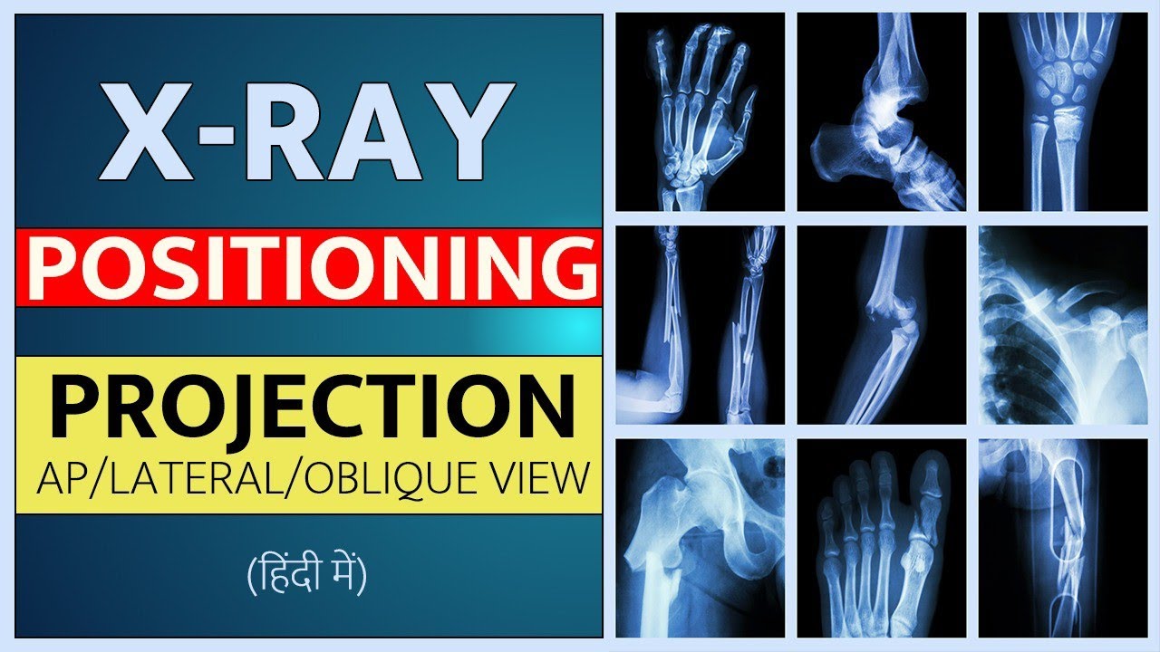 IMAGING OF BONES(HINDI) -HOW TO ORDER FOR BONE X RAY/ BASICS OF BONE IMAGING IN HINDI