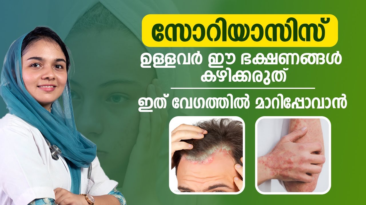 സോറിയാസിസ്  മാറാൻ കഴിക്കേണ്ട ഭക്ഷണങ്ങൾ |  psoriasis malayalam treatment |   chorichil maran.