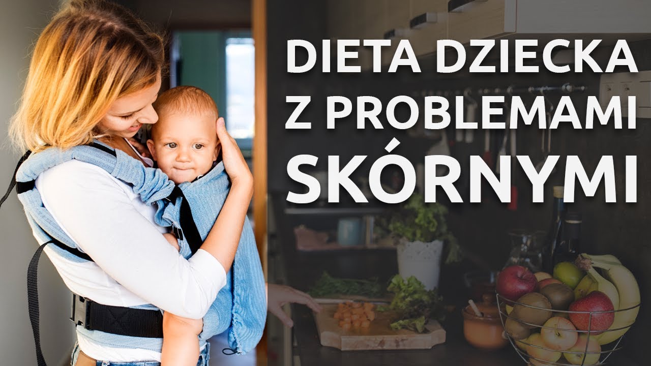 AZS u dzieci - jaką dietę stosować?
