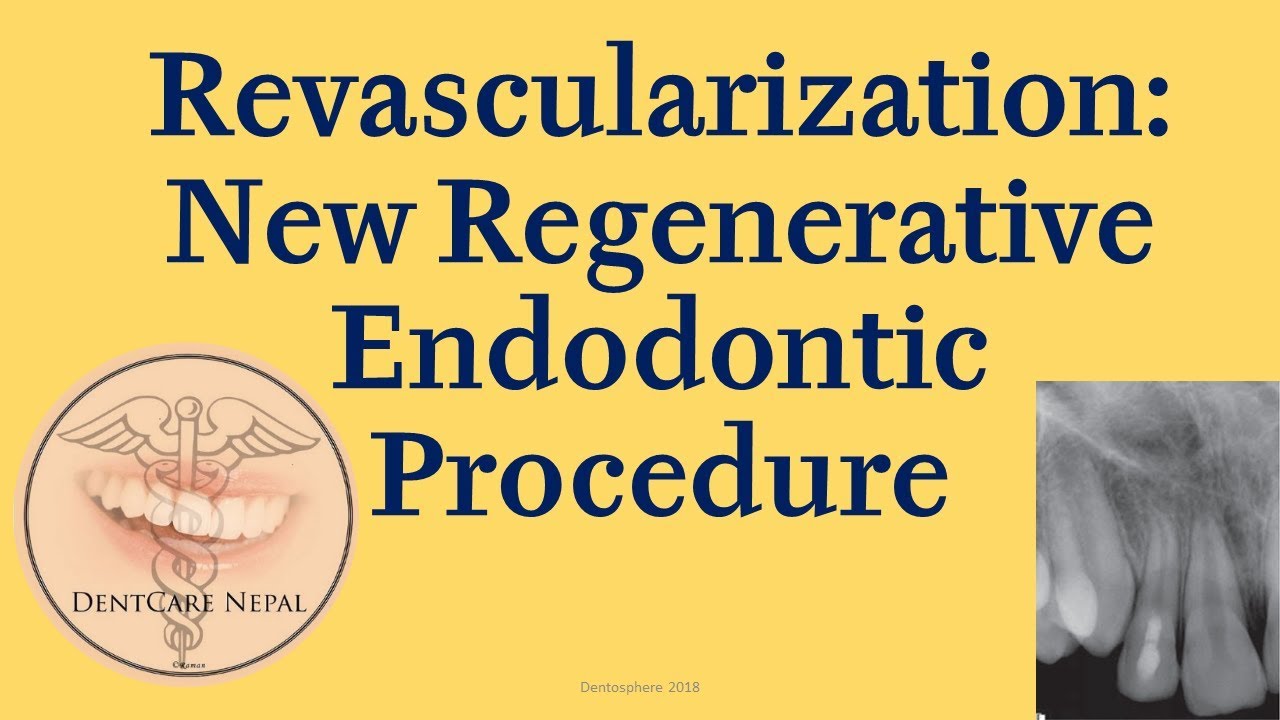 Revascularization - Regenerative Endodontic Procedure