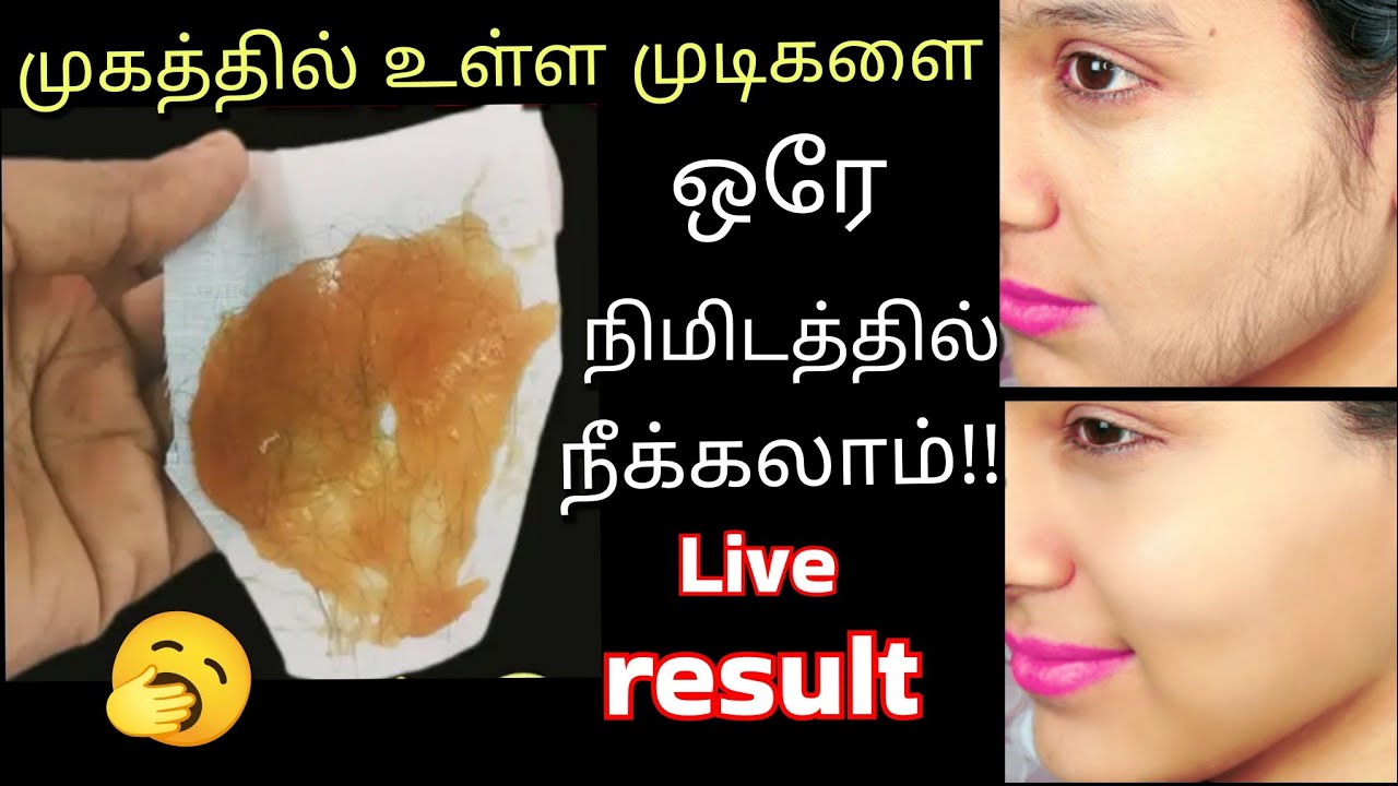 முகத்தில் உள்ள  முடிகளை ஒரே நிமிடத்தில் அகற்றலாம்!😱/hair removal at home/kitchen tips/@puthumaisamay