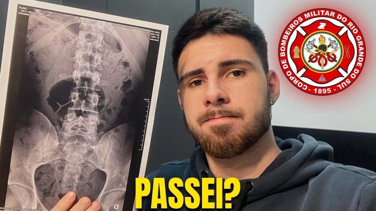 COMO É A ETAPA DE SAÚDE DO CONCURSO DOS BOMBEIROS? PASSEI!? (CBMRS)