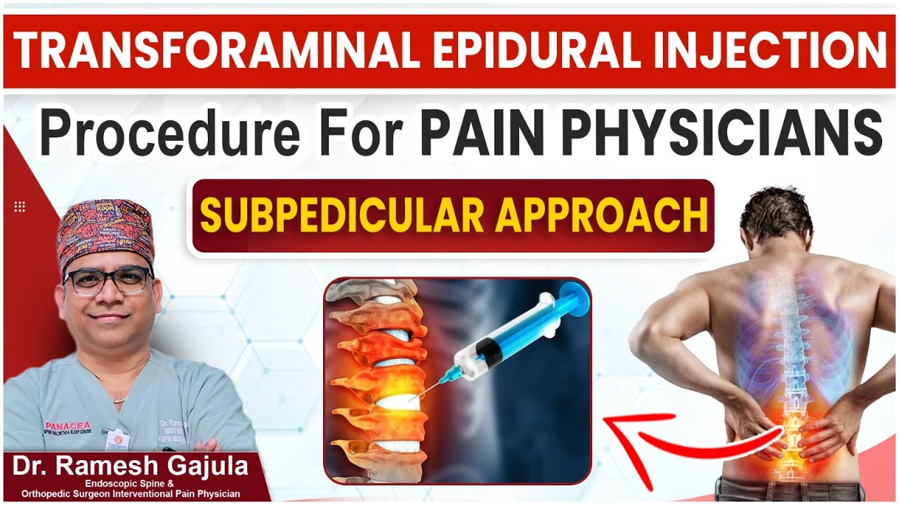 Transforaminal Epidural Injection Procedure For Pain Physicians | Subpedicular Approach | Panacea