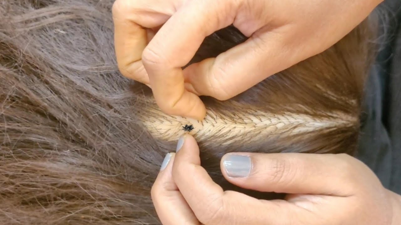 Scalp Check: The Most Satisfying ASMR Experience✨🌿✨