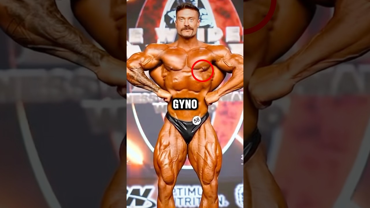 It&rsquo;s Possible to Remove Gyno NATURALLY!! #gymshorts #bodybuilding #gym