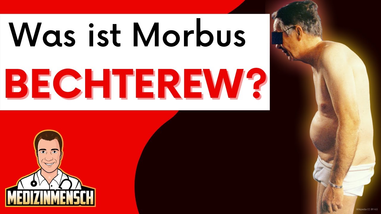 Morbus BECHTEREW: Diagnose, Symptome, HLA-B27 (RHEUMA-Arzt erklärt!)