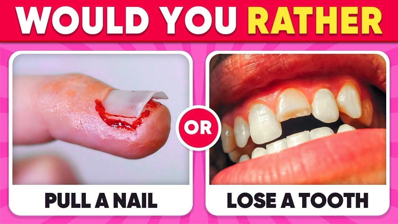 Would You Rather 😱 30 Extreme Choices That Will Blow Your Mind! 🔥🧠 Impossible Challenge