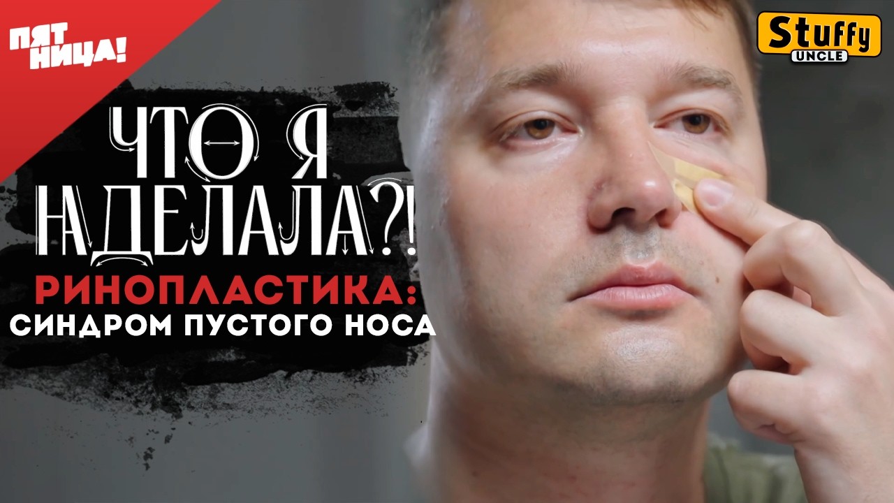 Что я наделала? - Ринопластика: синдром пустого носа
