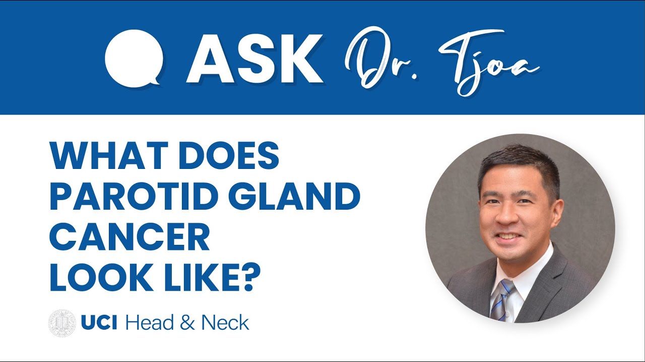 What Does Parotid Gland Cancer Look Like? - Dr. Tjoson Tjoa