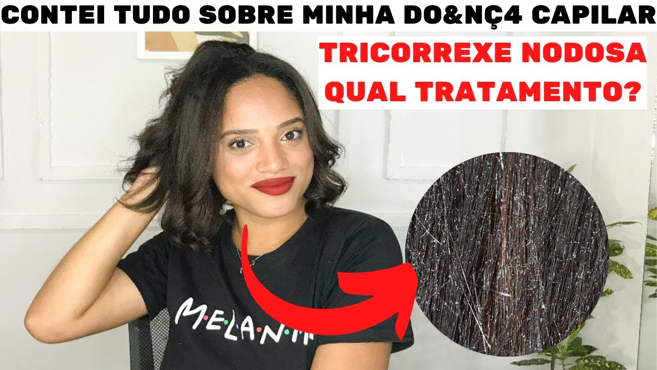 COMO ACABAR COM OS PONTINHOS BRANCOS NO CABELO - TRICORREXE NODOSA - TEM SOLUÇÃO? | Kevileen Silva