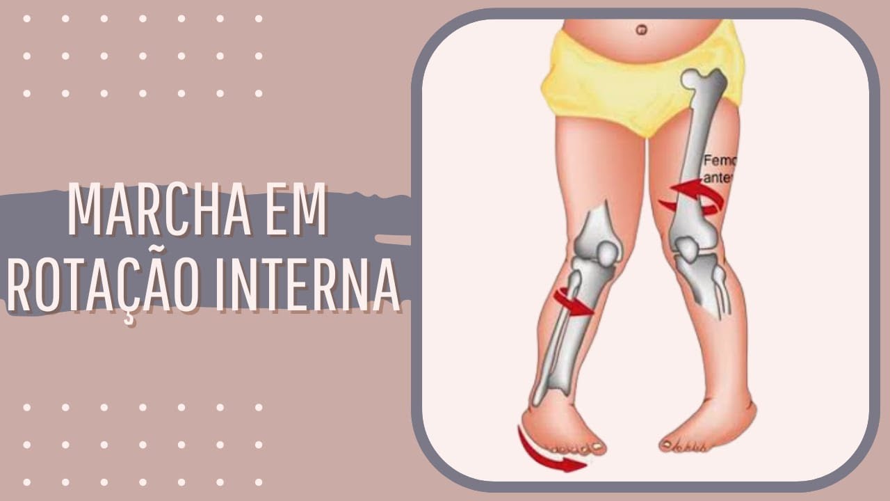Marcha em Rotação Interna