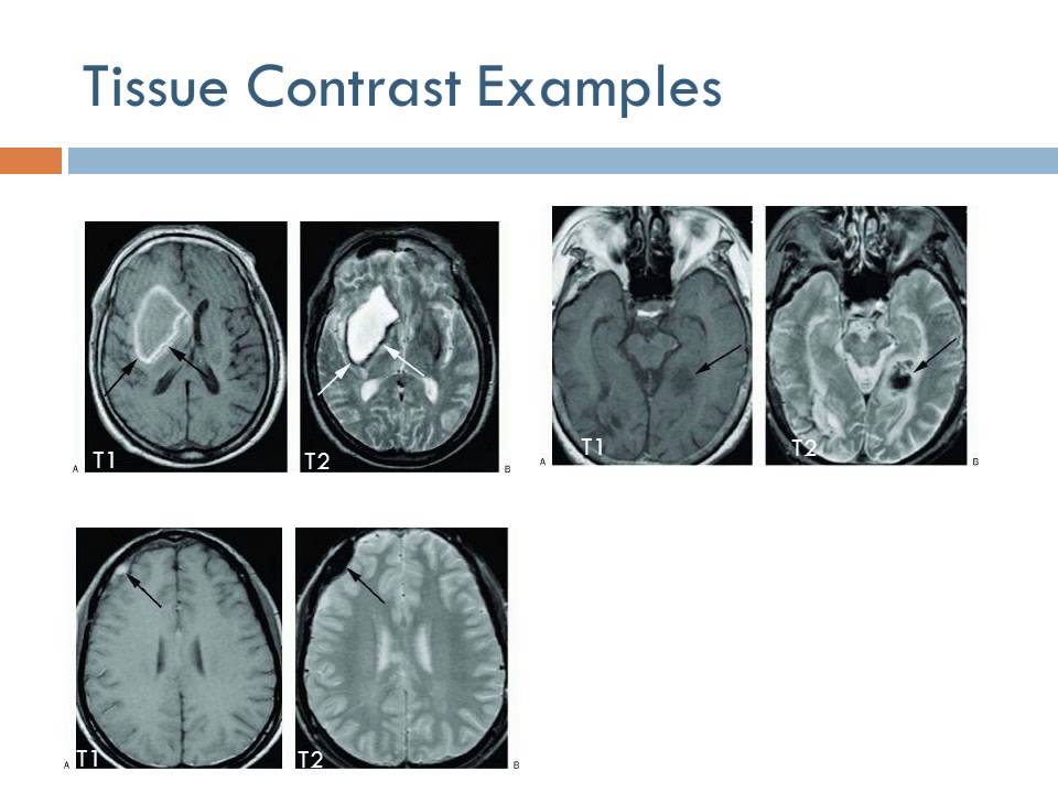 Medical Equipment: Magnetic Resonance Imaging (Arabic Narration)