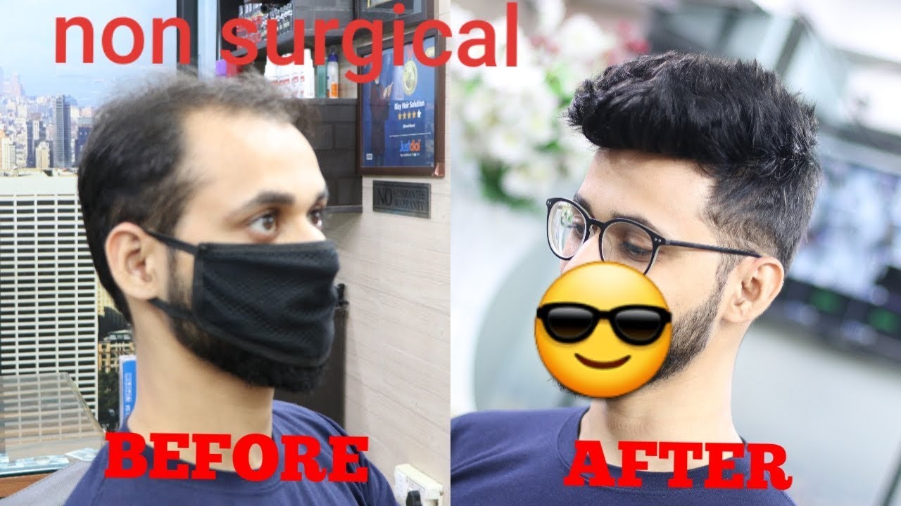 A non surgical  hair replacement | hair wigs | short spiky hair cut | by master RIZY 9599858612